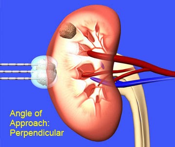 Photo of Kidney Cancer Institute in New York City, New York, United States - 3 Picture of Point of interest, Establishment, Health, Hospital, Doctor