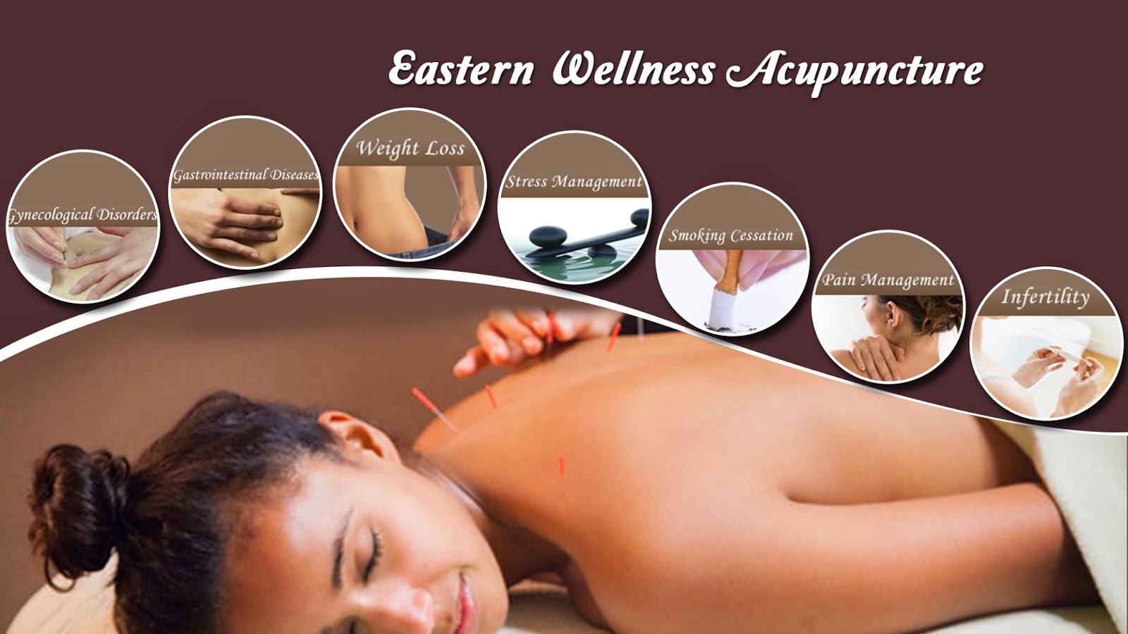 Photo of Eastern Wellness Acupuncture in Scarsdale City, New York, United States - 3 Picture of Point of interest, Establishment, Health