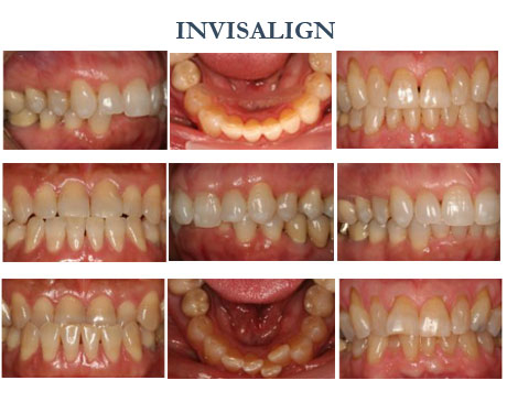 Photo of 80 Park Avenue Dental: Barry Sporer, DMD in New York City, New York, United States - 4 Picture of Point of interest, Establishment, Health, Dentist