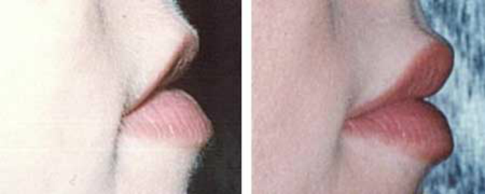 Photo of Lip Injections NYC in New York City, New York, United States - 6 Picture of Point of interest, Establishment, Health, Doctor