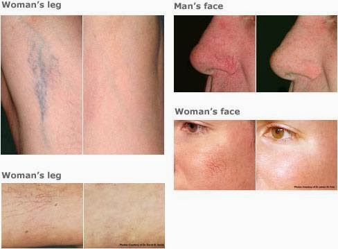Photo of Enhance Laser skin care in Edgewater City, New Jersey, United States - 1 Picture of Point of interest, Establishment, Health