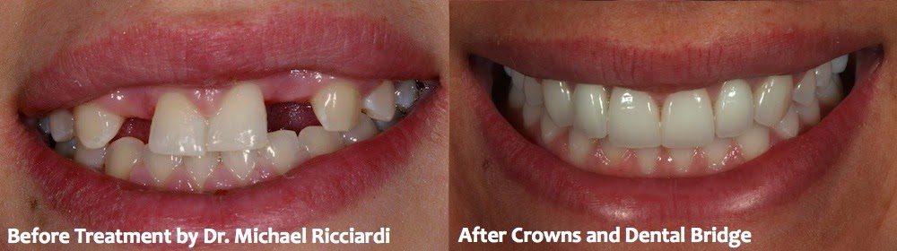 Photo of Dr. Michael T. Ricciardi, DDS in Staten Island City, New York, United States - 7 Picture of Point of interest, Establishment, Health, Dentist