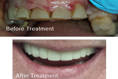 Photo of Evan Mondshine DDS PC in Flushing City, New York, United States - 6 Picture of Point of interest, Establishment, Health, Dentist