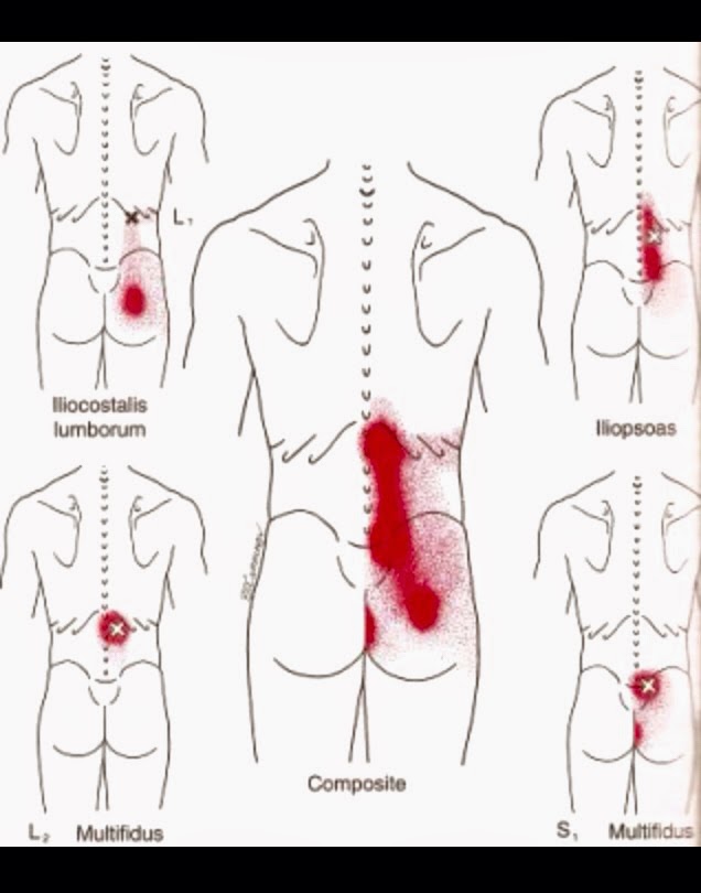 Photo of Bob Sirianni Acupuncture in New York City, New York, United States - 3 Picture of Point of interest, Establishment, Health, Doctor