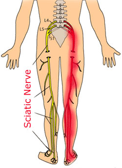 Photo of Phillip Jose Gomez, DPT in New York City, New York, United States - 4 Picture of Point of interest, Establishment, Health