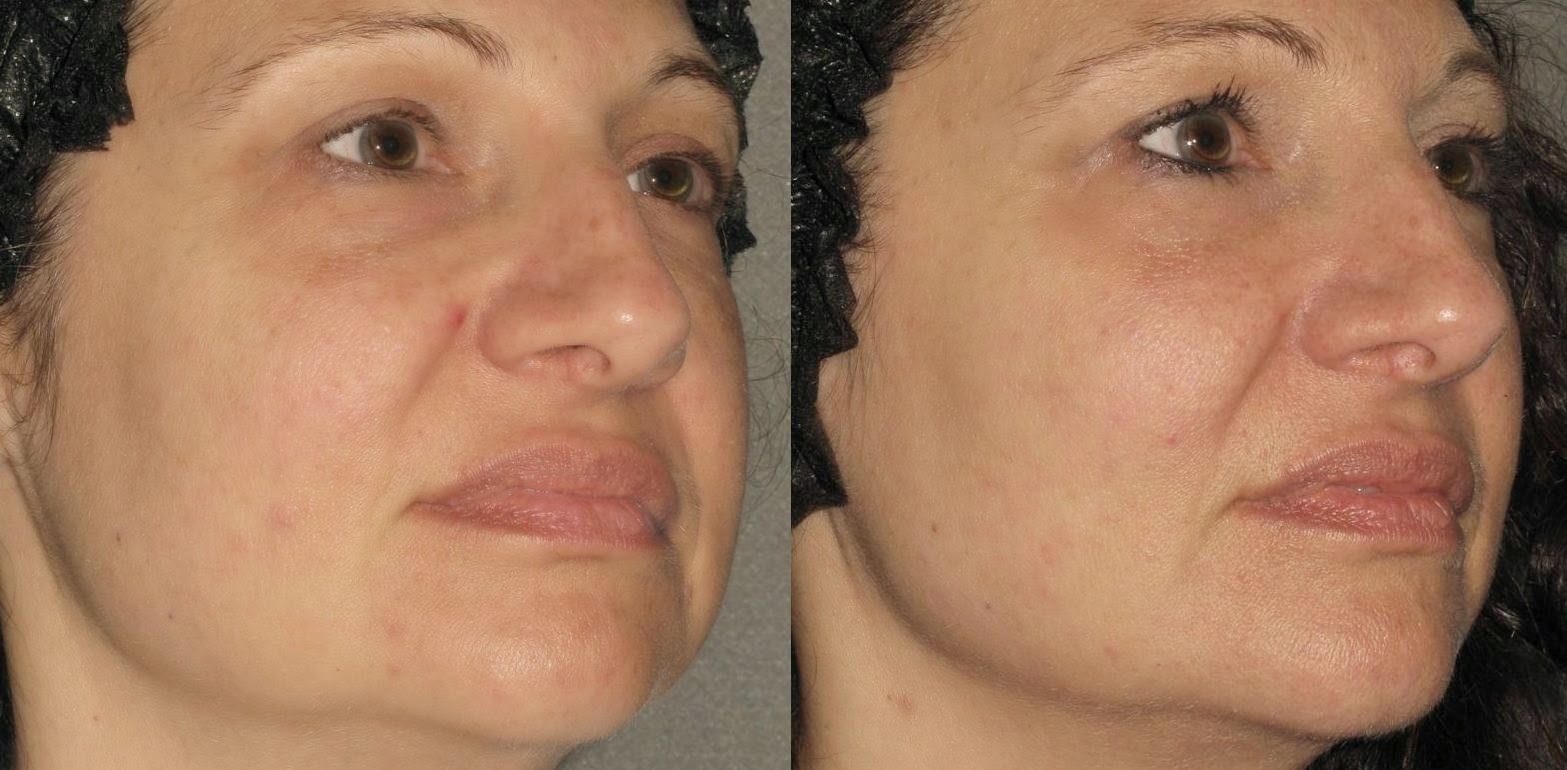 Photo of Cosmetic Laser MD in Livingston City, New Jersey, United States - 4 Picture of Point of interest, Establishment, Health, Doctor, Spa, Beauty salon, Hair care