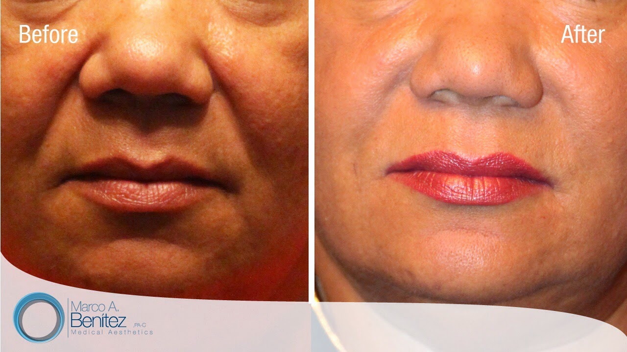 Photo of Premier Aesthetics- Astoria Botox Dermal Filler Plasma PRP in Queens City, New York, United States - 10 Picture of Point of interest, Establishment, Health, Spa