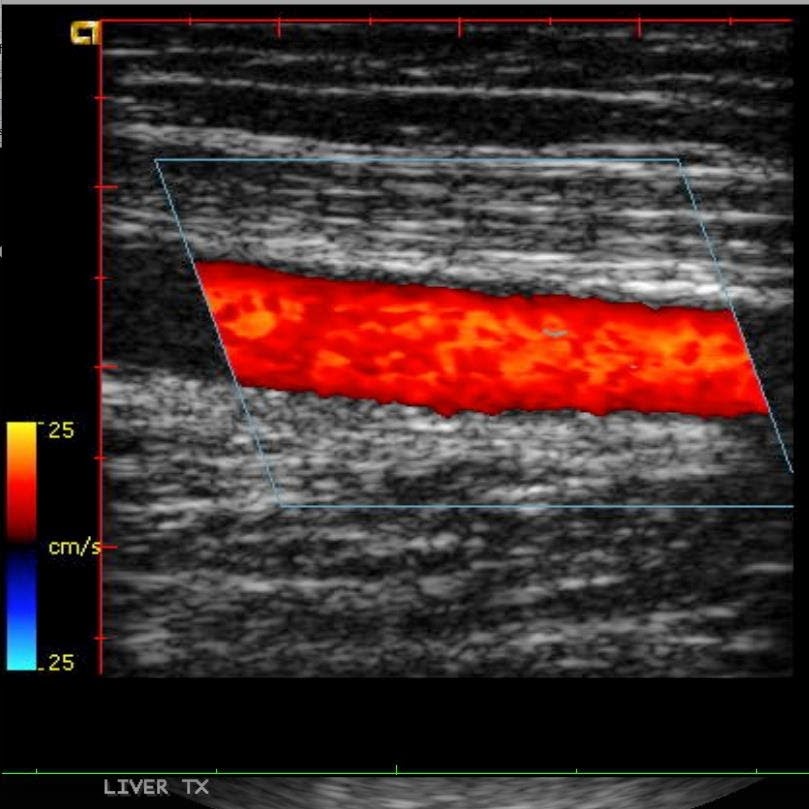 Photo of TMU - Total Mobile Ultrasound in West Orange City, New Jersey, United States - 1 Picture of Point of interest, Establishment, Health
