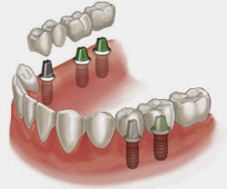 Photo of Macabi Dental Associates in Roslyn City, New York, United States - 6 Picture of Point of interest, Establishment, Health, Dentist