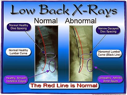 Photo of Beebe Chiropractic in Bayonne City, New Jersey, United States - 3 Picture of Point of interest, Establishment, Health