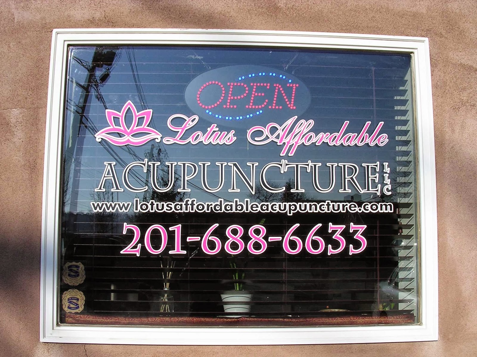 Photo of Lotus Affordable Acupuncture, LLC. in Lodi City, New Jersey, United States - 2 Picture of Point of interest, Establishment, Health