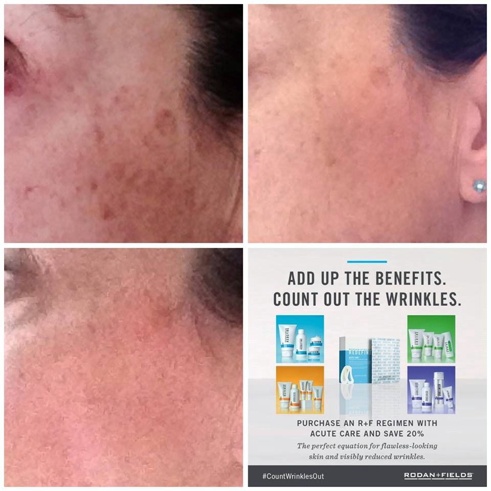 Photo of Hedy Taranto Rodan + Fields in New Rochelle City, New York, United States - 2 Picture of Point of interest, Establishment, Health
