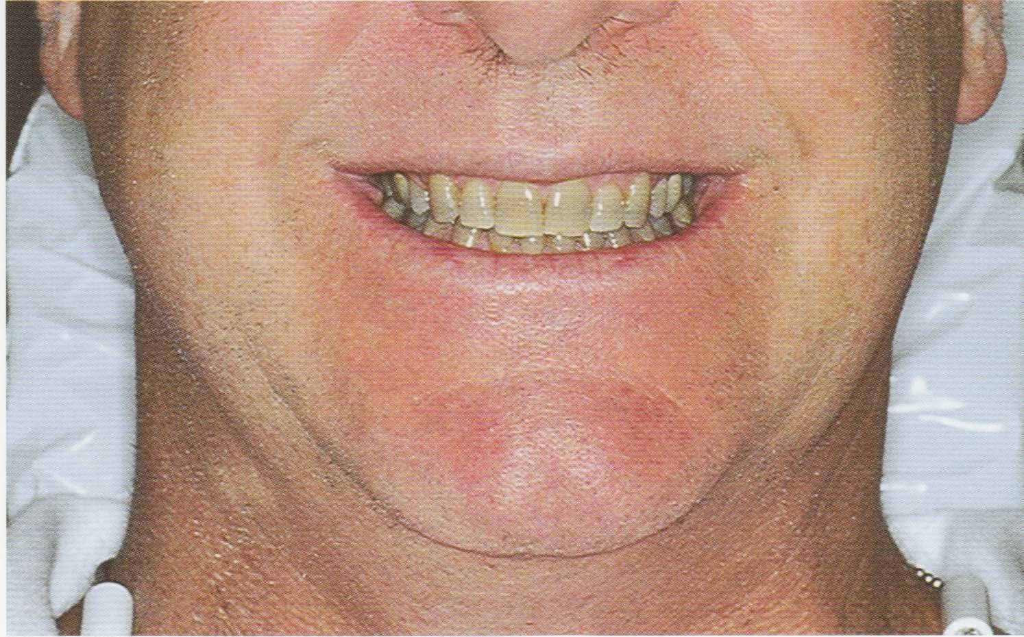 Photo of Louis P Sterling DDS in Staten Island City, New York, United States - 7 Picture of Point of interest, Establishment, Health, Doctor, Dentist