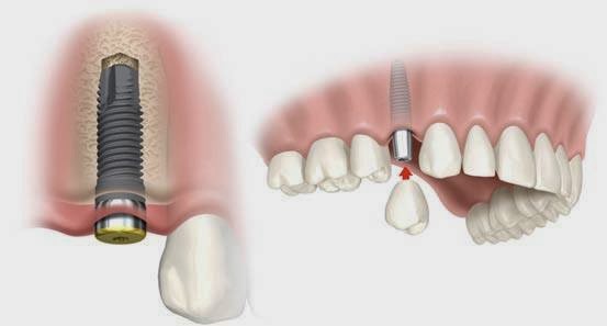 Photo of Catherine Chen DDS PC in Englewood Cliffs City, New Jersey, United States - 2 Picture of Point of interest, Establishment, Health, Dentist