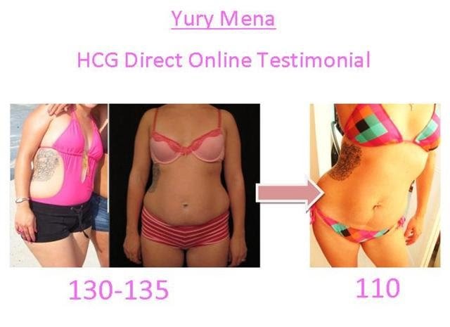 Photo of HCG Diet New York in Kings County City, New York, United States - 1 Picture of Point of interest, Establishment, Health