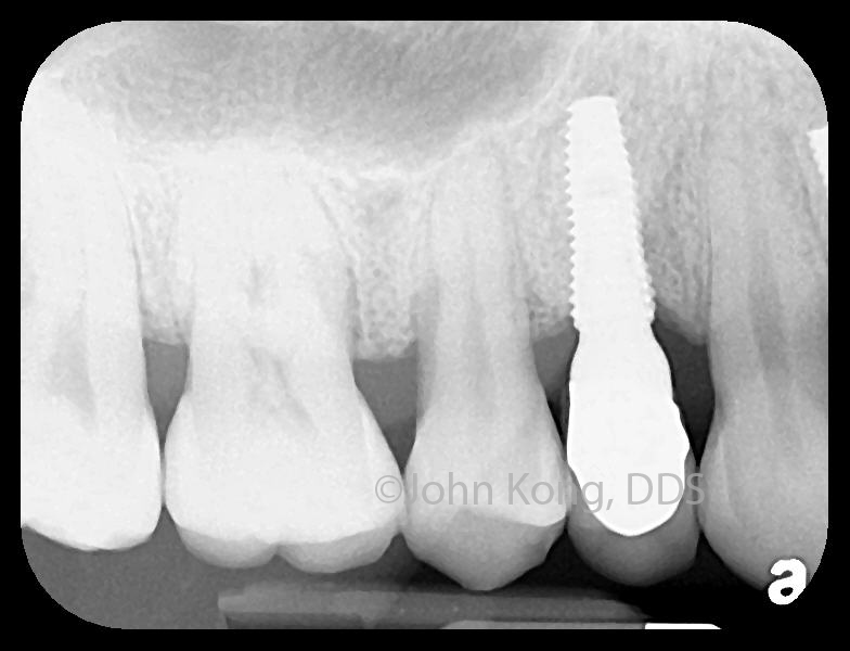 Photo of John Kong, DDS : Better Living through Dentistry - NYC in New York City, New York, United States - 7 Picture of Point of interest, Establishment, Health, Dentist