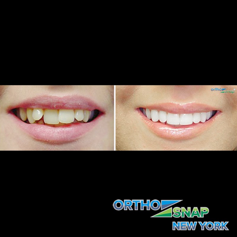 Photo of OrthoSnap New York in New York City, New York, United States - 3 Picture of Point of interest, Establishment, Health, Dentist