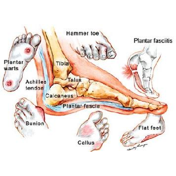 Photo of American Foot Care Centers of LI in Rockville Centre City, New York, United States - 4 Picture of Point of interest, Establishment, Health, Doctor