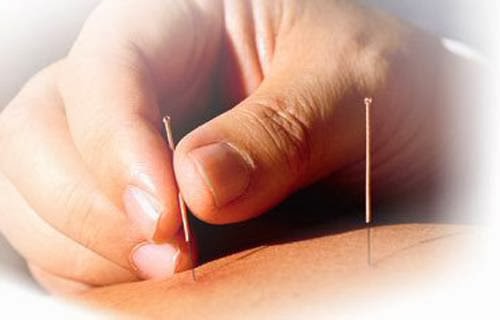 Photo of Dr. Chen Acupuncture PC in New York City, New York, United States - 1 Picture of Point of interest, Establishment, Health