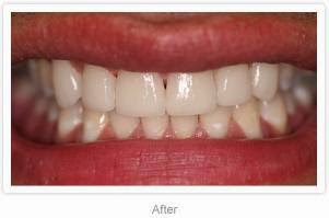 Photo of Hollywood Smile Dental in Rego Park City, New York, United States - 1 Picture of Point of interest, Establishment, Health, Dentist
