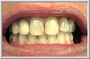 Photo of Tricorache Joanna DDS in Staten Island City, New York, United States - 3 Picture of Point of interest, Establishment, Health, Dentist