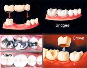 Photo of Dr. Yanina Kravets DDS in Brooklyn City, New York, United States - 10 Picture of Point of interest, Establishment, Health, Dentist