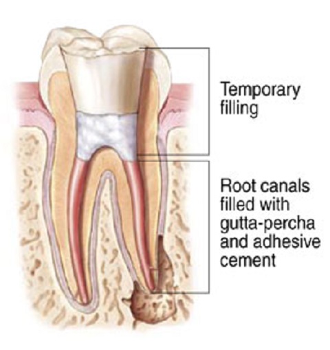 Photo of Sheldon Kupferman DDS in Bronx City, New York, United States - 7 Picture of Point of interest, Establishment, Health, Doctor, Dentist