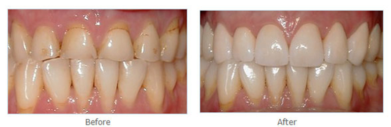 Photo of R & S Dental Associates in Clifton City, New Jersey, United States - 10 Picture of Point of interest, Establishment, Health, Dentist