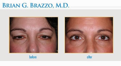 Photo of NYC Eyelid and Ophthalmic Plastic Surgery in New York City, New York, United States - 3 Picture of Point of interest, Establishment, Health, Doctor