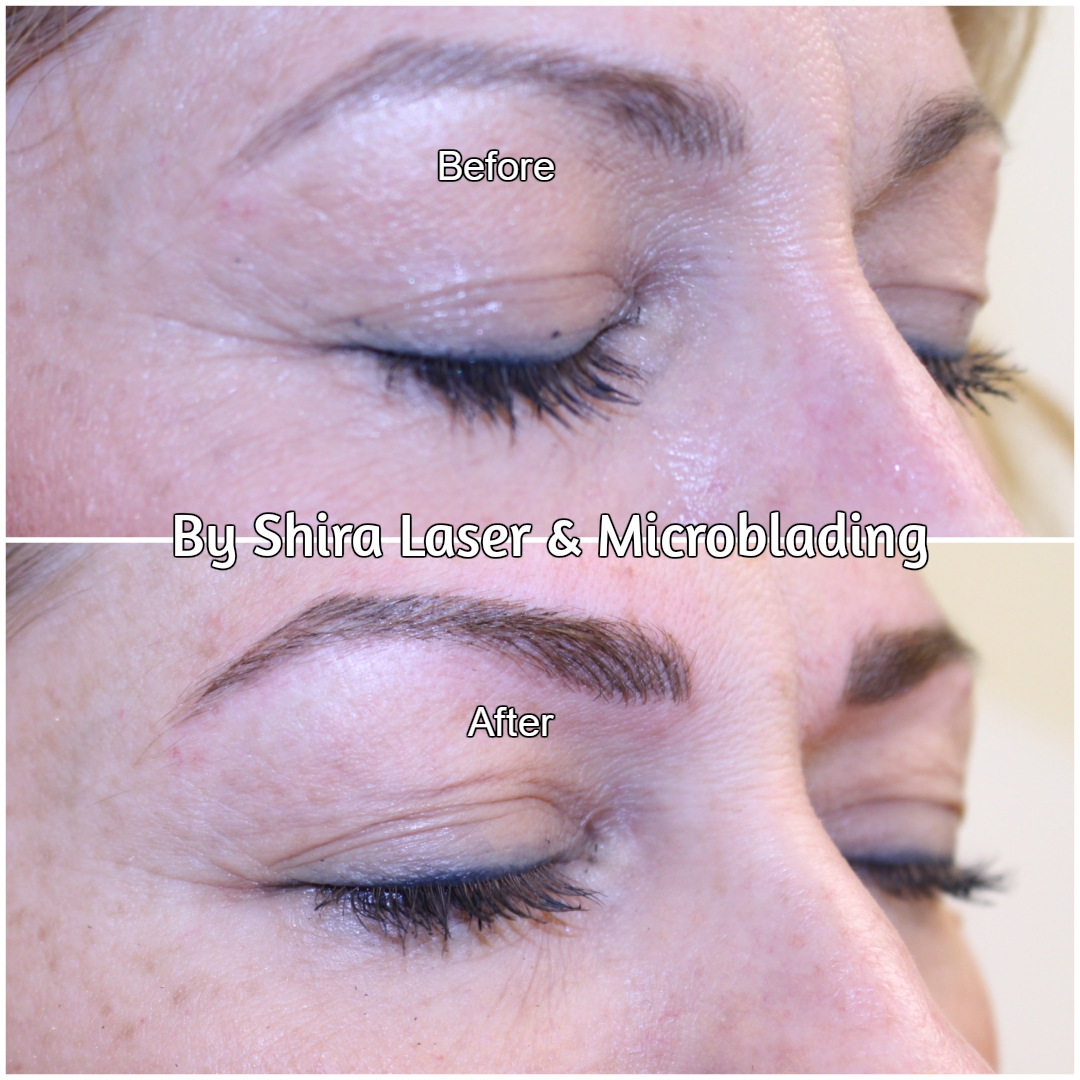 Photo of Shira Laser & Microblading in Brooklyn City, New York, United States - 6 Picture of Point of interest, Establishment, Health, Beauty salon, Hair care