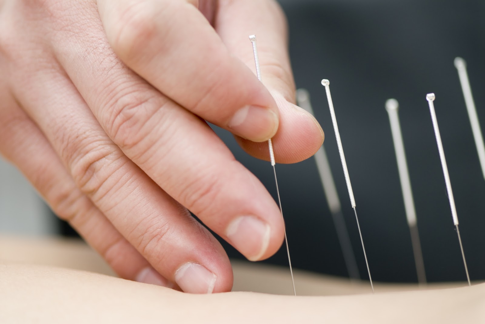 Photo of Bloomfield Alternative Health - Acupuncture Medicine Therapy | Acupuncture Therapist in Great Neck City, New York, United States - 2 Picture of Point of interest, Establishment, Health