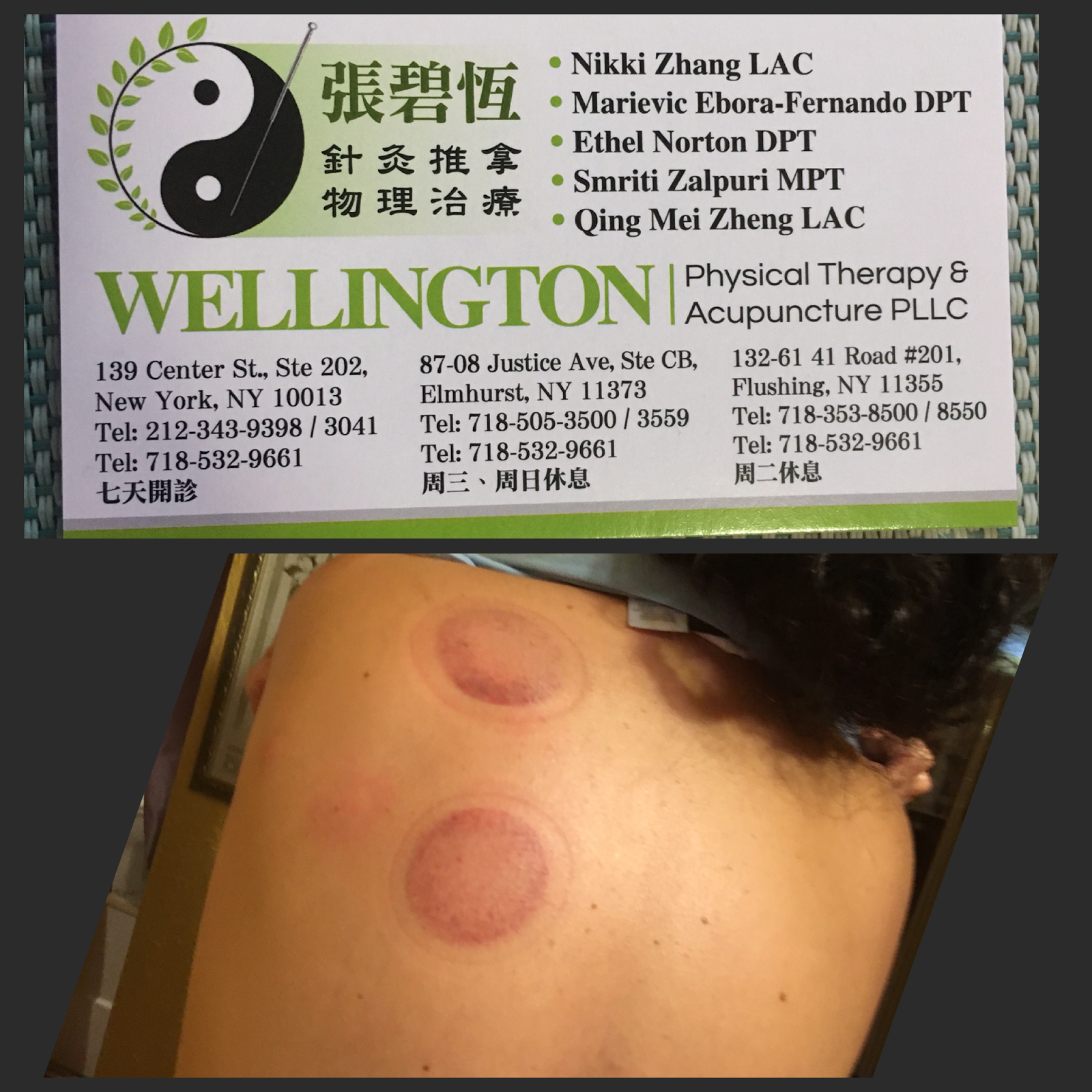 Photo of Wellington PT and Acupuncture in Queens City, New York, United States - 1 Picture of Point of interest, Establishment, Health, Doctor