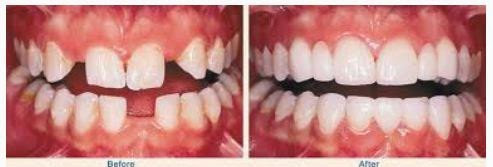 Photo of Fidelity Dental Care - Dr. M. F. Karam DDS in Bronx City, New York, United States - 5 Picture of Point of interest, Establishment, Health, Dentist