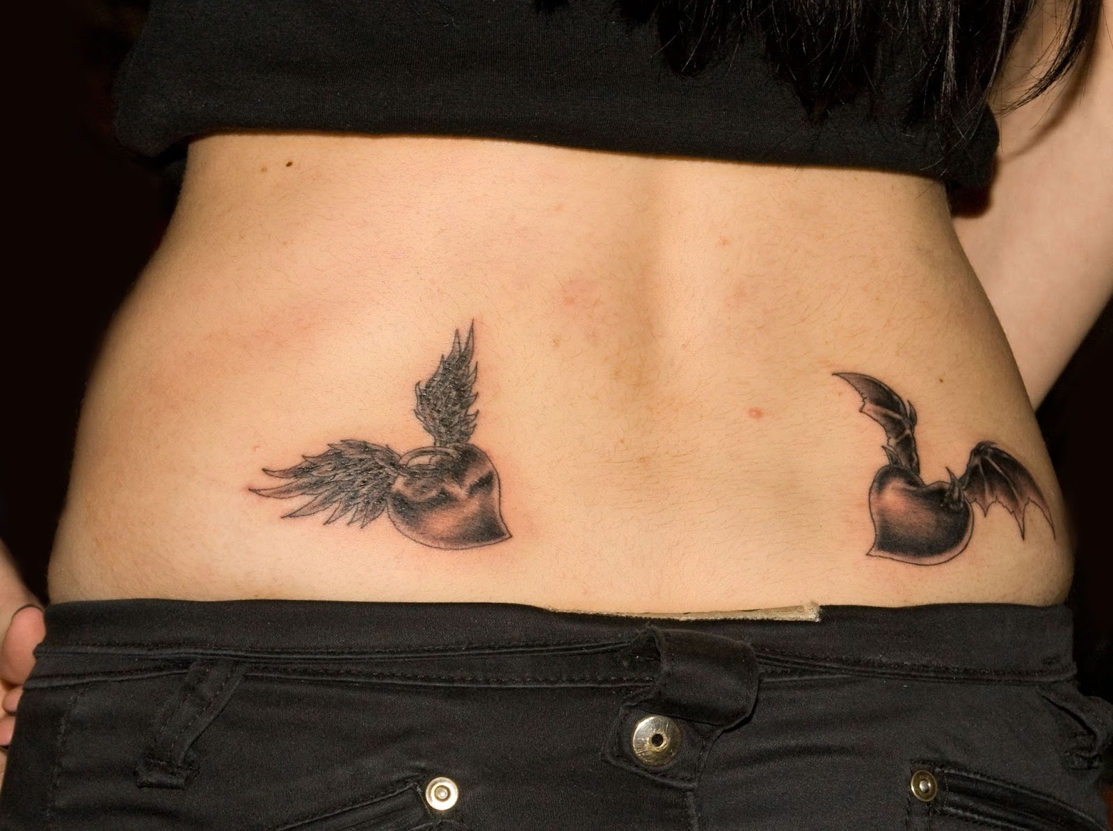 Photo of Tattoo Removal Long Island - Vaginal Rejuvenation Long Island - Evan Shapiro MD in New Hyde Park City, New York, United States - 3 Picture of Point of interest, Establishment, Health, Doctor, Beauty salon, Hair care