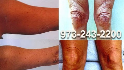 Photo of Dr. Fretta's Total Vein Care in West Orange City, New Jersey, United States - 2 Picture of Point of interest, Establishment, Health, Doctor