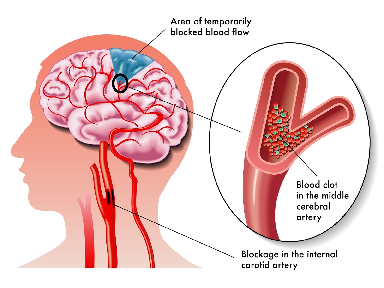 Photo of Westchester Surgery PC / Ogedi Ohajekwe MD in Bronxville City, New York, United States - 1 Picture of Point of interest, Establishment, Health, Doctor