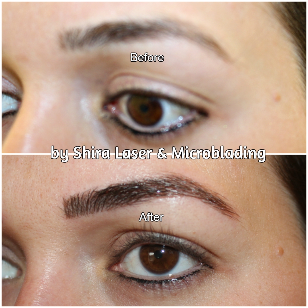 Photo of Shira Laser & Microblading in Brooklyn City, New York, United States - 2 Picture of Point of interest, Establishment, Health, Beauty salon, Hair care