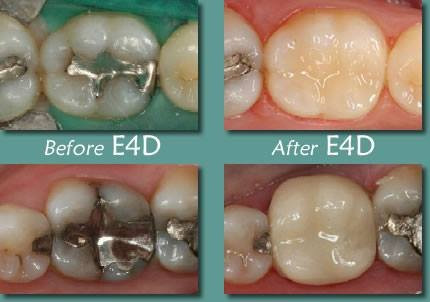 Photo of Advanced Dental Concepts in Queens City, New York, United States - 8 Picture of Point of interest, Establishment, Health, Dentist