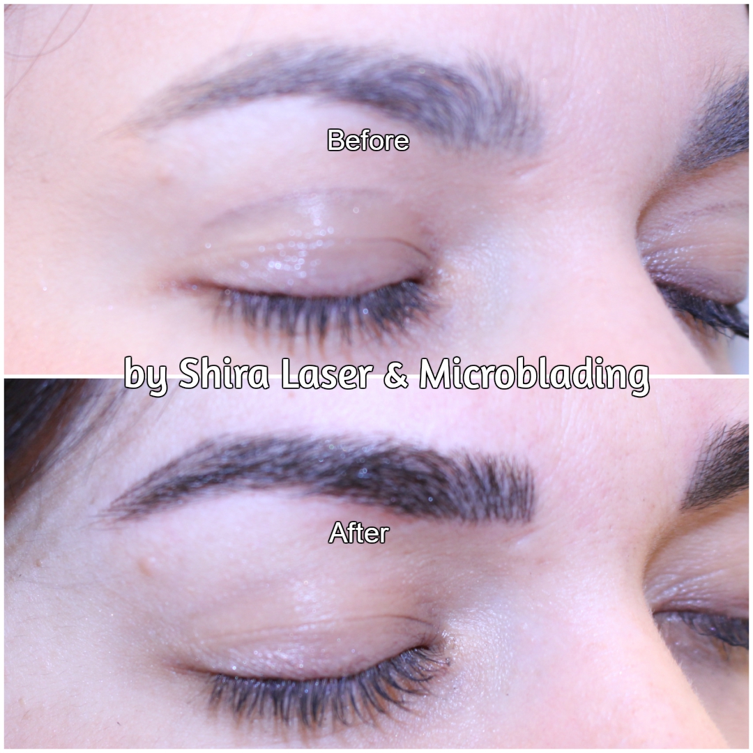 Photo of Shira Laser & Microblading in Brooklyn City, New York, United States - 8 Picture of Point of interest, Establishment, Health, Beauty salon, Hair care
