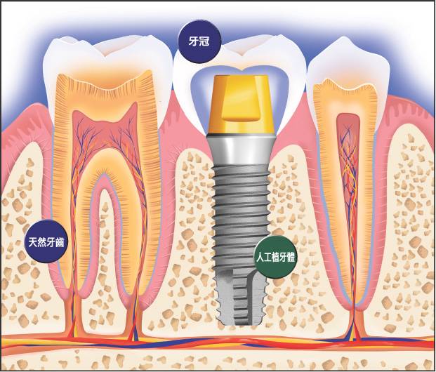 Photo of Charlie Chen DDS / 诚和植牙牙科中心 / 3D Dental Implant Center in Kings County City, New York, United States - 6 Picture of Point of interest, Establishment, Health, Doctor, Dentist