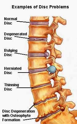 Photo of SportsMed Physical Therapy - Fair Lawn NJ in Fair Lawn City, New Jersey, United States - 6 Picture of Point of interest, Establishment, Health, Physiotherapist