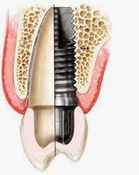 Photo of Family Dental Rego Park, Dr.B.K.Verma in Elmhurst City, New York, United States - 5 Picture of Point of interest, Establishment, Health, Dentist