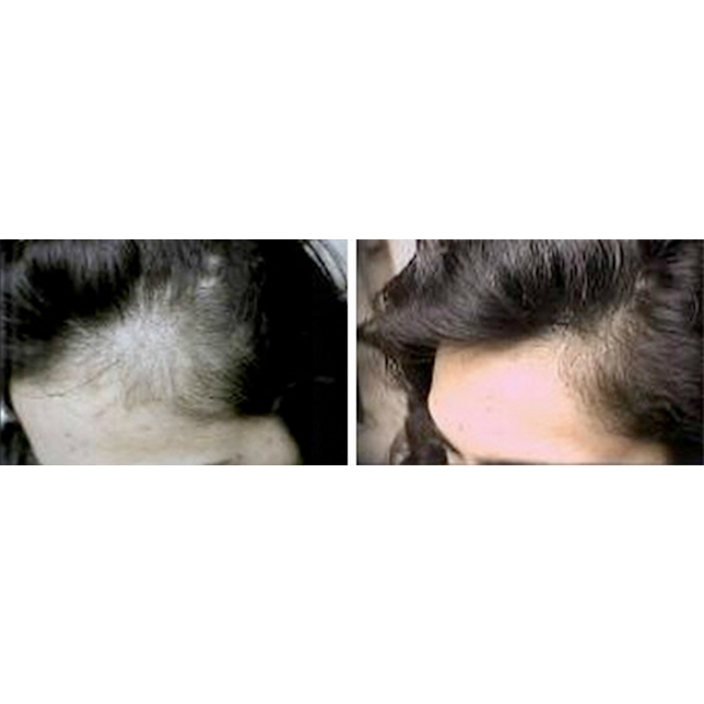 Photo of USNY Trichology Institute Hair Loss Specialty Group in New York City, New York, United States - 2 Picture of Point of interest, Establishment, Health, Hair care