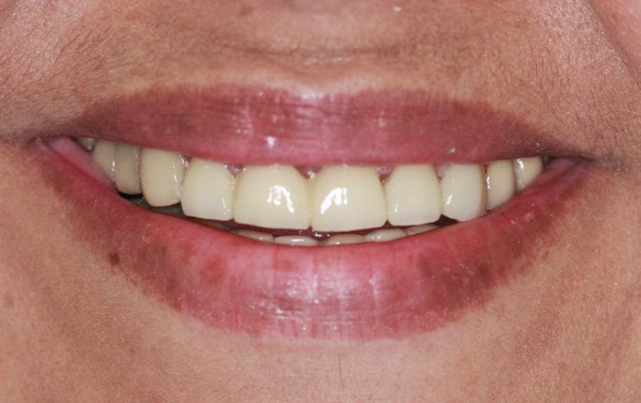 Photo of Cosmetic Dentistry: Dr. Valentin and Alexander Lezhansky DDS in Brooklyn City, New York, United States - 2 Picture of Point of interest, Establishment, Health, Dentist