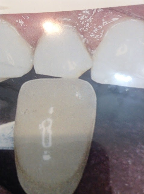 Photo of First Choice Dental in Elmhurst City, New York, United States - 1 Picture of Point of interest, Establishment, Health, Dentist