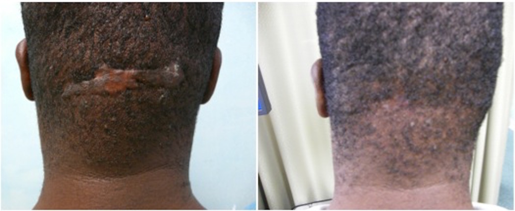 Photo of Black Dermatology NYC in New York City, New York, United States - 2 Picture of Point of interest, Establishment, Health, Doctor