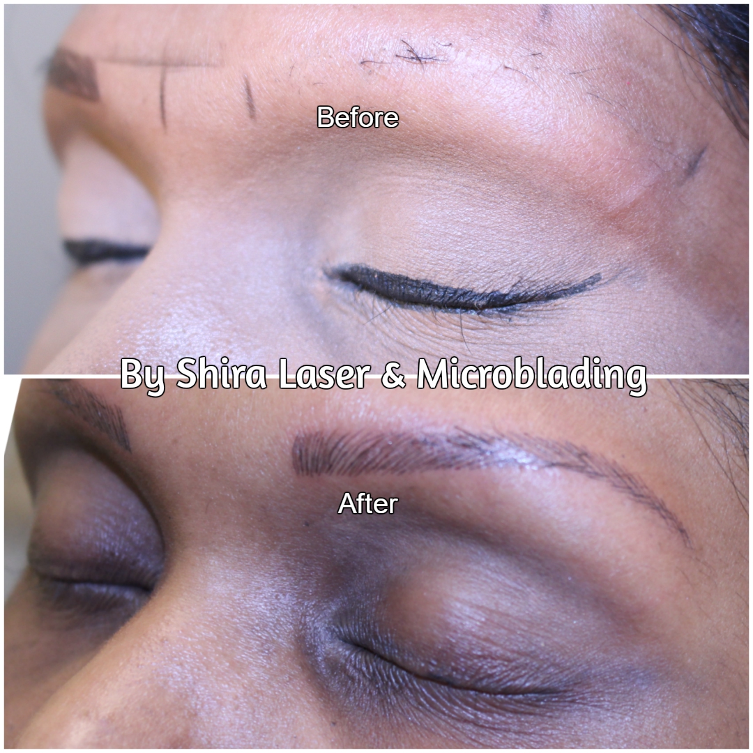 Photo of Shira Laser & Microblading in Brooklyn City, New York, United States - 10 Picture of Point of interest, Establishment, Health, Beauty salon, Hair care