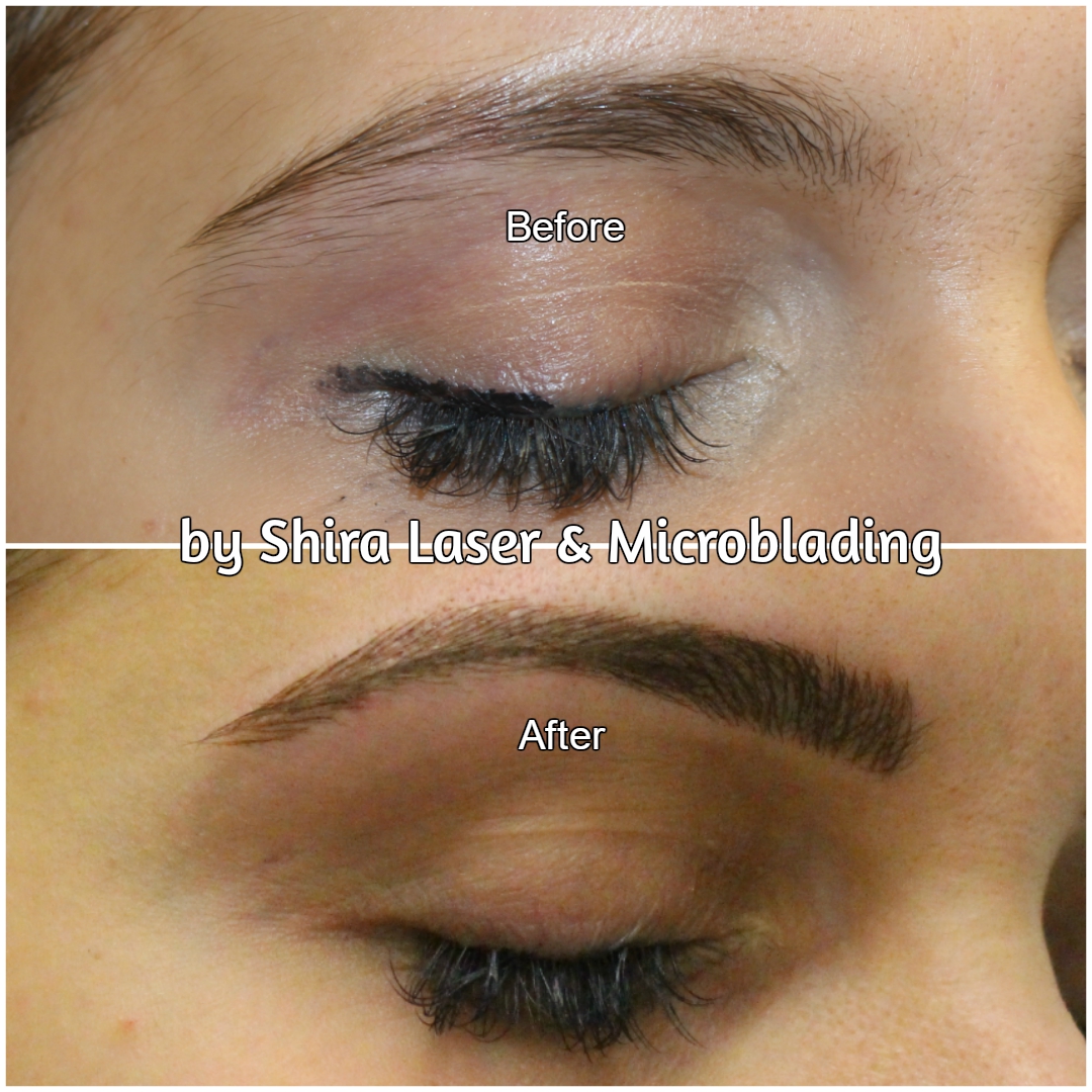 Photo of Shira Laser & Microblading in Brooklyn City, New York, United States - 9 Picture of Point of interest, Establishment, Health, Beauty salon, Hair care