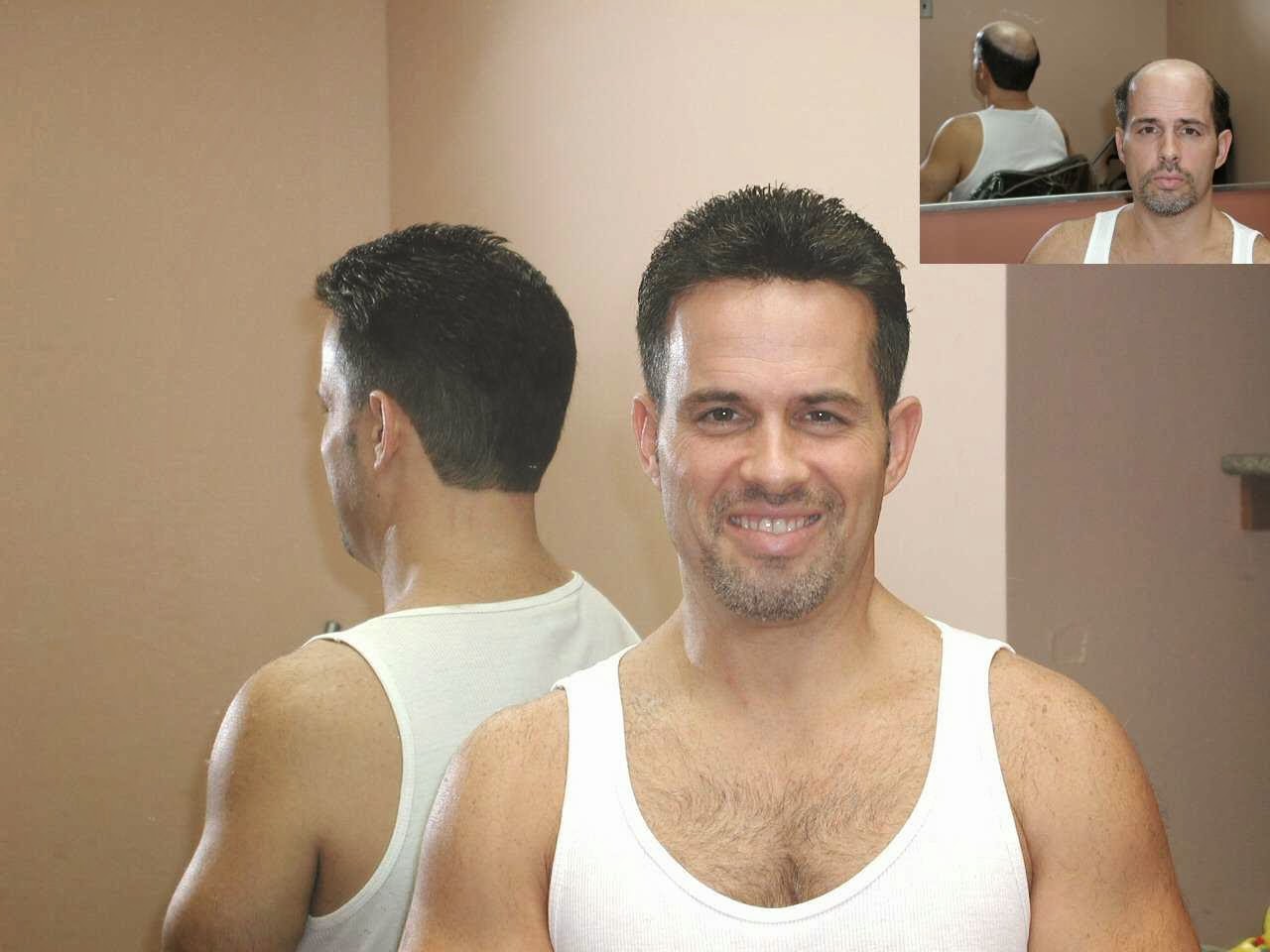 Photo of Manny Roberts Hair Replacement in Roslyn Heights City, New York, United States - 2 Picture of Point of interest, Establishment, Store, Health, Beauty salon, Hair care