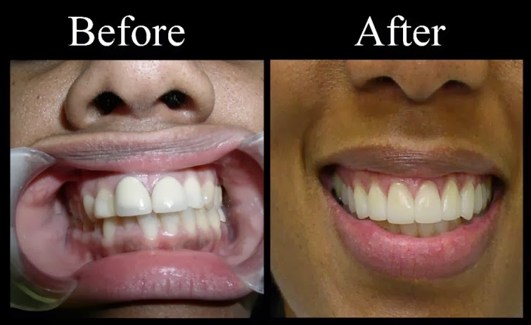 Photo of Smiles Unlimited in Rockville Centre City, New York, United States - 3 Picture of Point of interest, Establishment, Health, Dentist